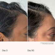 Scalp Care Density Serum