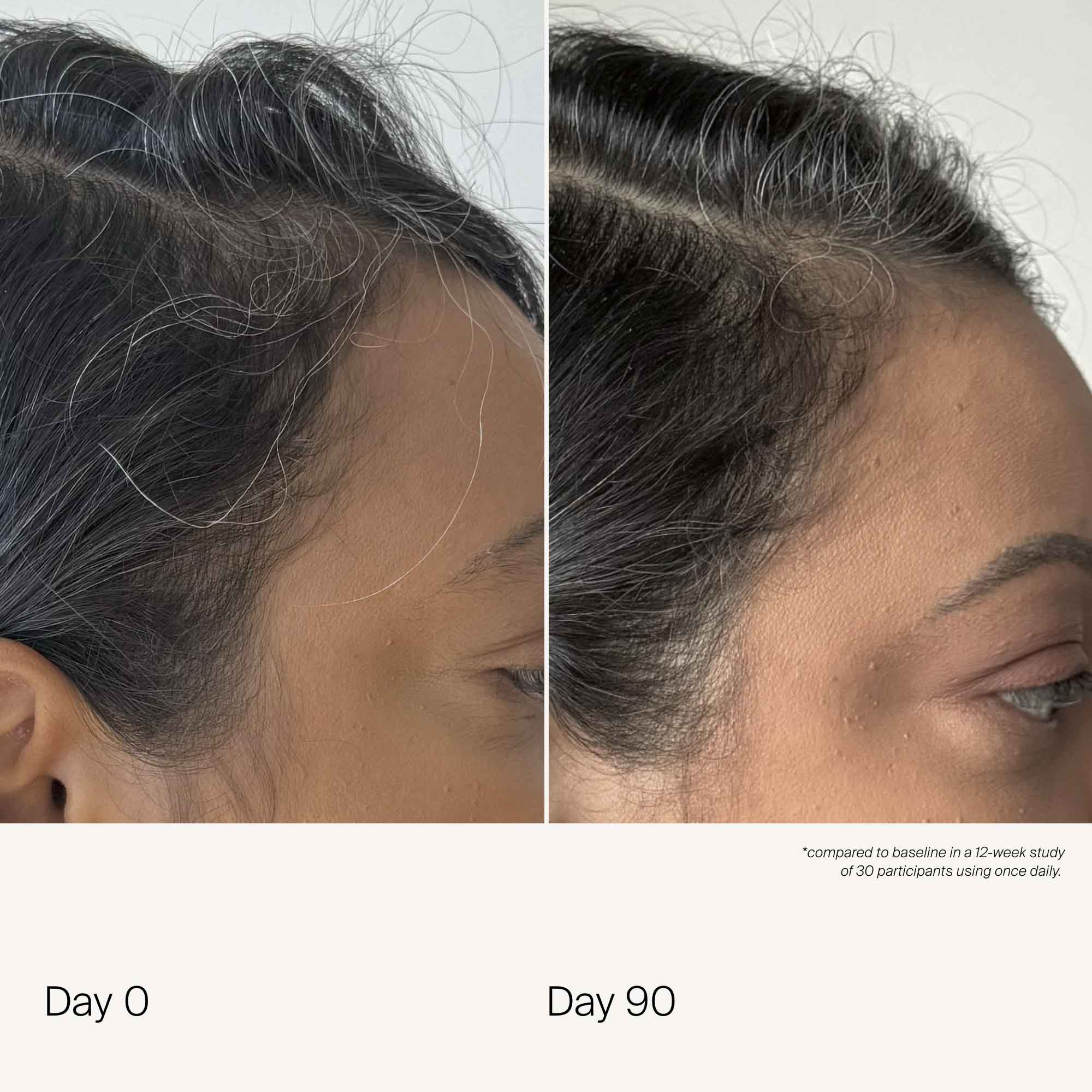 Scalp Care Density Serum 2-Pack