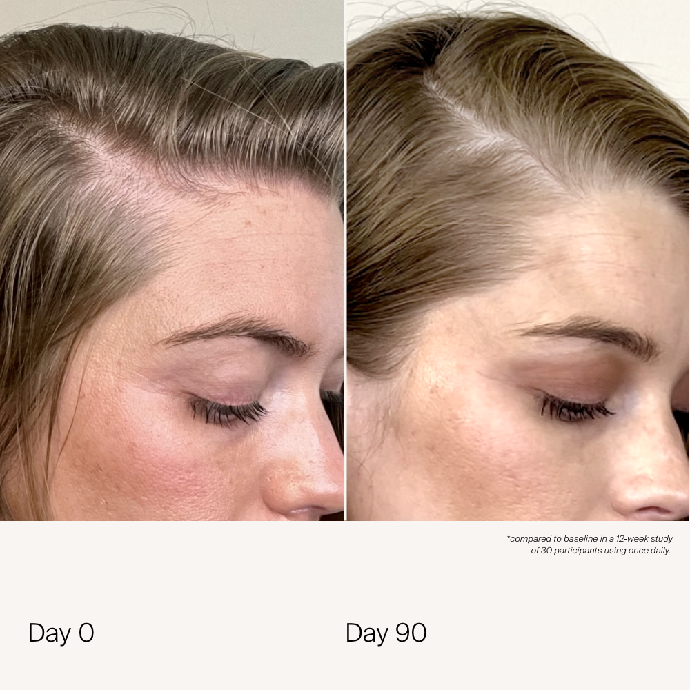 Scalp Care Density Serum 2-Pack