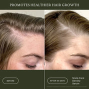 Scalp Care Density Serum 3-Pack